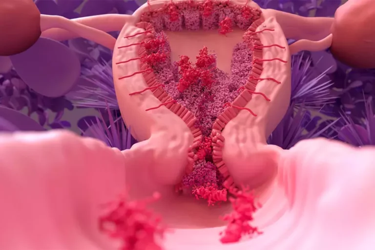 خونریزی پریودی