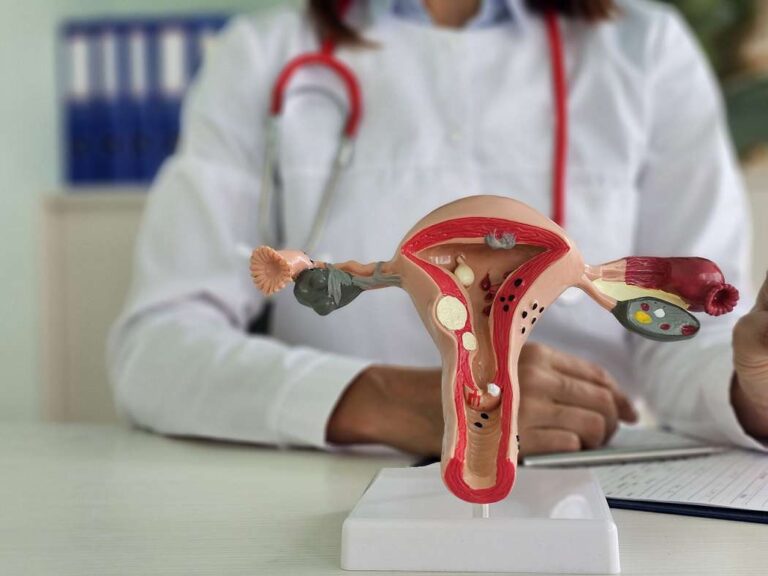 تعریف کیست نرمال